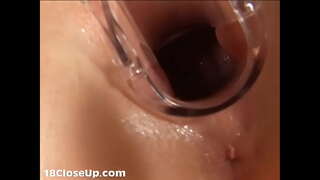 Julia ny Gynecologic Fanadinana sy ny Pussy Fitrandrahana (misy amin'ny FullHD)